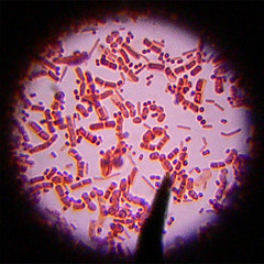 Žmoguje gyvena iki 2000 skirtingų bakterijų